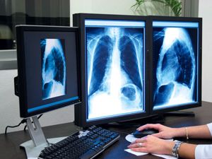 Eskil Devlet Hastanesi’ne  son teknolojik röntgen cihazı
